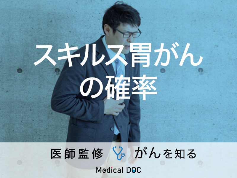 「スキルス胃がんになる確率が高い人」はご存知ですか？症状についても解説！