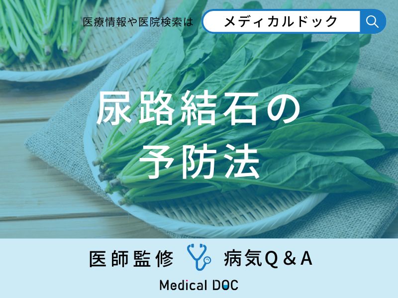 「尿路結石」を予防する食べ物・飲み物をご存知ですか？