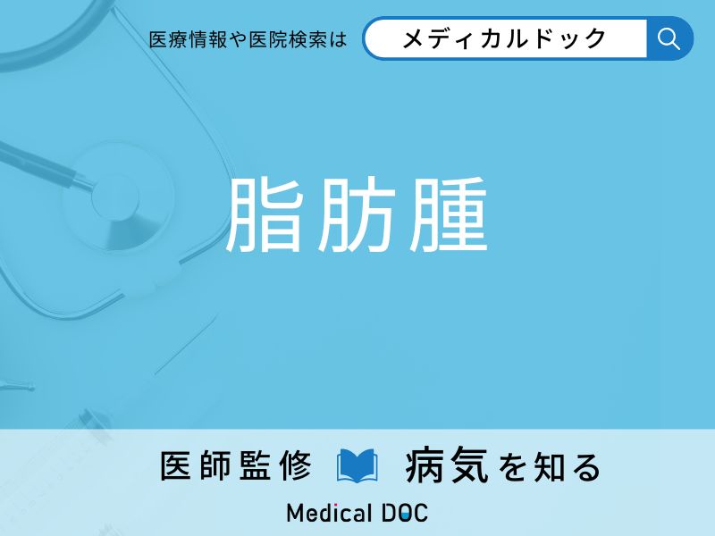 「脂肪腫」になりやすい人の特徴はご存知ですか？ 原因・症状を併せて医師が解説