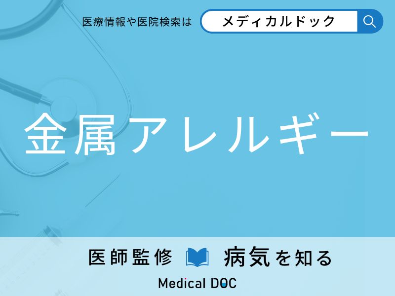 「金属アレルギー」になりやすい人の特徴はご存知ですか？ 原因・症状を併せて医師が解説