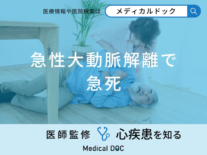 「急性大動脈解離で急死する前に現れる症状」はご存知ですか？医師が解説！