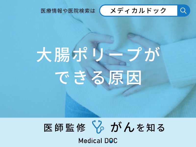 「大腸ポリープができる3つの原因」はご存知ですか？医師が徹底解説！