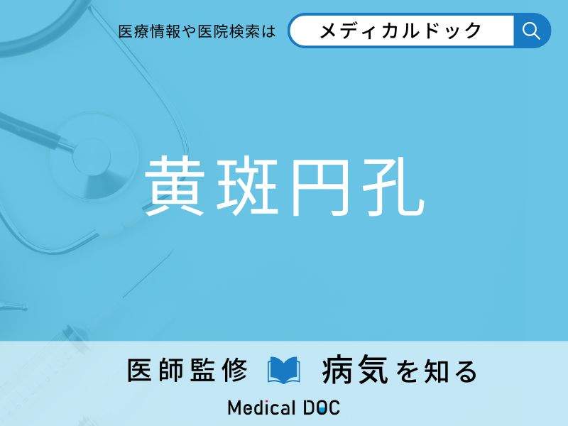 「黄斑円孔」になりやすい人の特徴はご存知ですか？ 原因・症状を併せて医師が解説