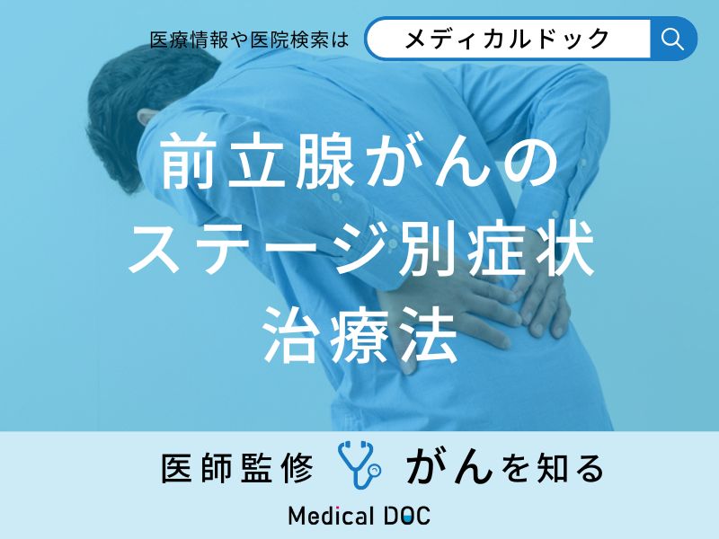 「前立腺がんのステージ別症状・治療法」はご存知ですか？【医師監修】