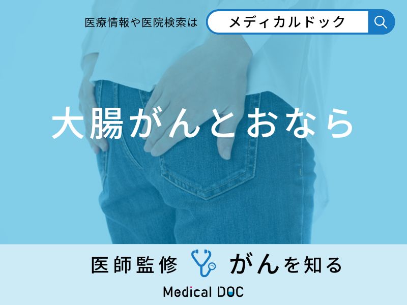 「おなら」がよく出るのは「大腸がん」の初期症状？【医師監修】