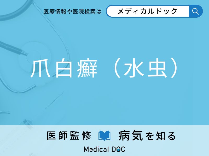 「白癬菌」に感染するとどうなるかご存知ですか？ 症状を併せて医師が解説