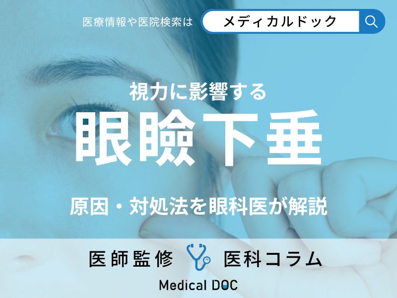 まぶたが視力に影響していることをご存じですか? 「眼瞼下垂」の原因・対処法を眼科医が徹底解説