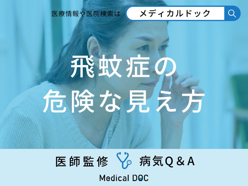 「飛蚊症」の危険な見え方・原因はご存知ですか？医師が監修！