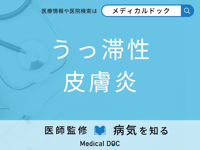 「うっ滞性皮膚炎」になりやすい人の特徴はご存知ですか？ 原因・症状を併せて医師が解説