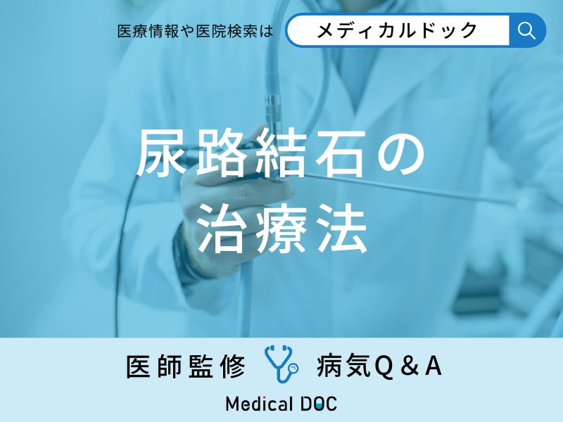 「尿路結石」の治療法はご存知ですか？【医師監修】