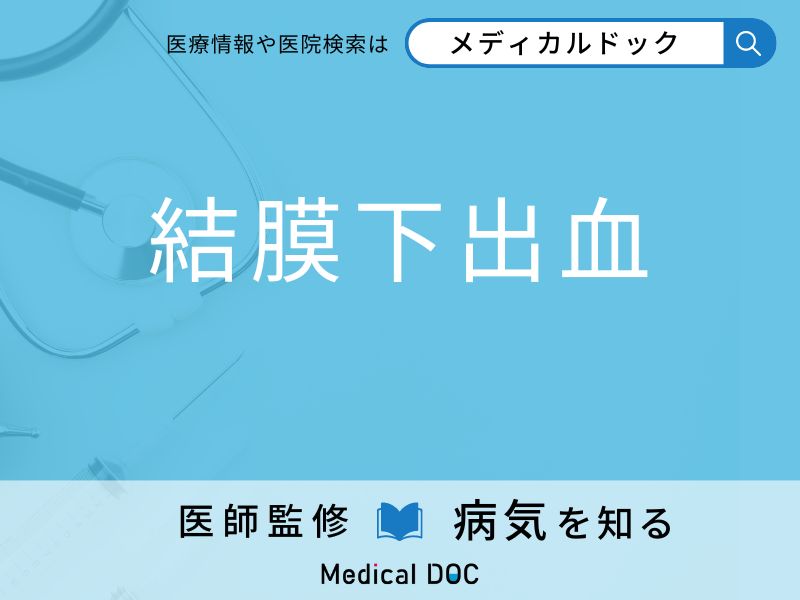 「結膜下出血」を疑うべき初期症状はご存知ですか？ 原因を併せて医師が解説