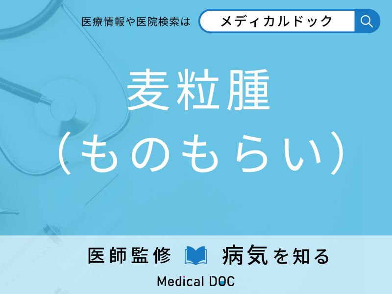 「ものもらい」になりやすい人の特徴はご存知ですか？ 原因・症状を併せて医師が解説