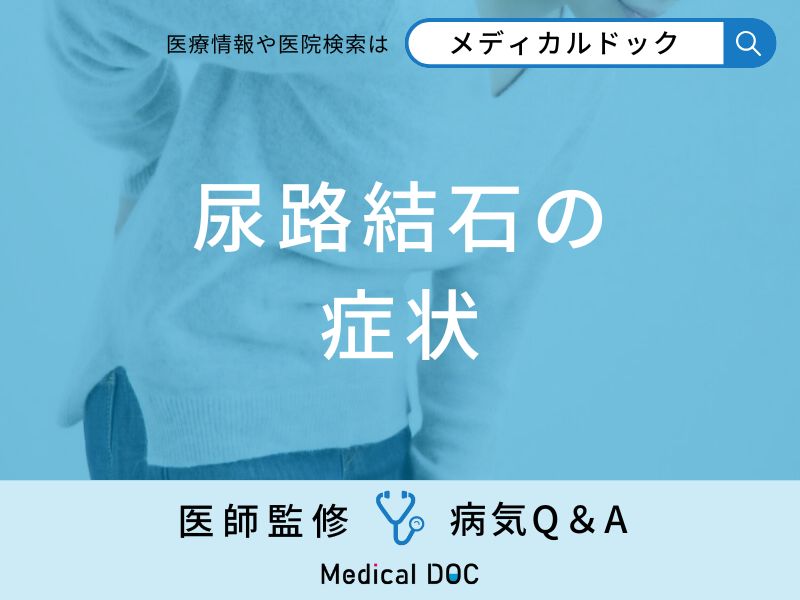 「尿路結石」の症状はご存知ですか？【医師監修】