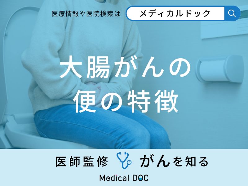 「大腸がんを疑う便の特徴」はご存知ですか？医師が監修！