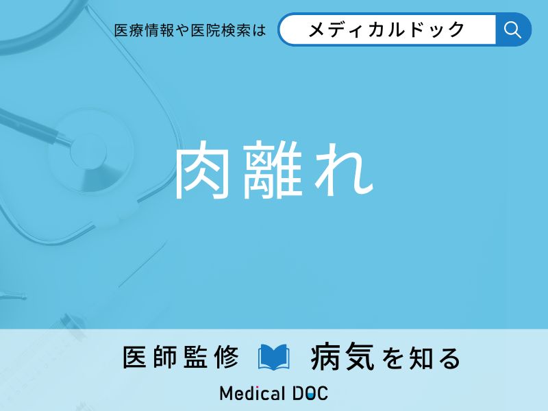 「肉離れ」を起こしやすい人の特徴はご存知ですか？ 原因・症状を併せて医師が解説