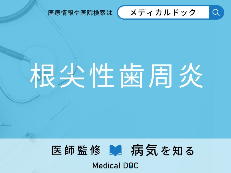 「根尖性歯周炎」になりやすい人の特徴はご存知ですか？ 原因・症状を併せて医師が解説