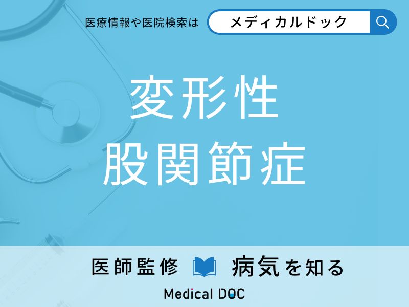 「変形性股関節症」になりやすい人の特徴はご存知ですか？ 原因・症状を併せて医師が解説