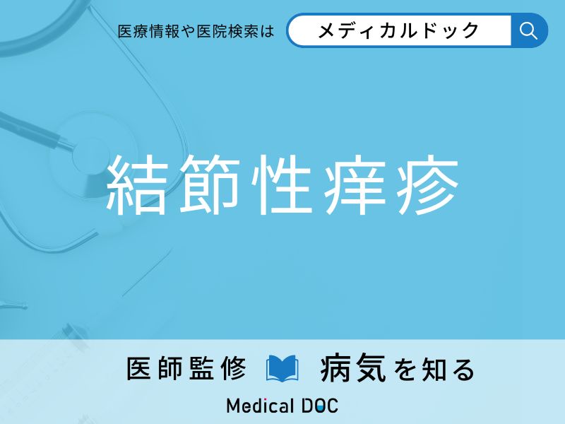 「結節性痒疹」になりやすい人の特徴はご存知ですか？ 原因・症状を併せて医師が解説