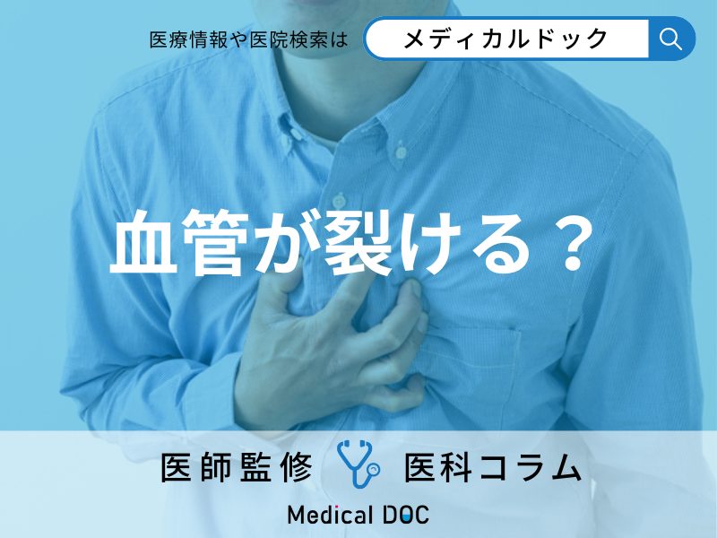 「急性大動脈解離」の3つの初期症状はご存じですか? 前兆・発症のサインを医師が解説!