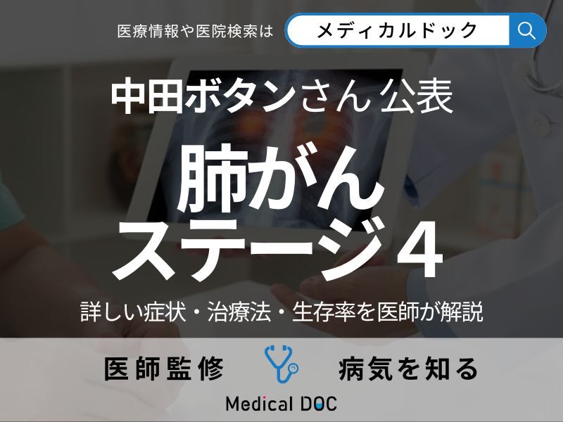 中田ボタンさんが公表｢ステージ4の肺がん｣ 詳しい症状や治療法、生存率を医師が解説