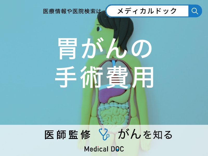 「胃がんの手術費用」はどれくらい？検査費用も併せて解説！【医師監修】