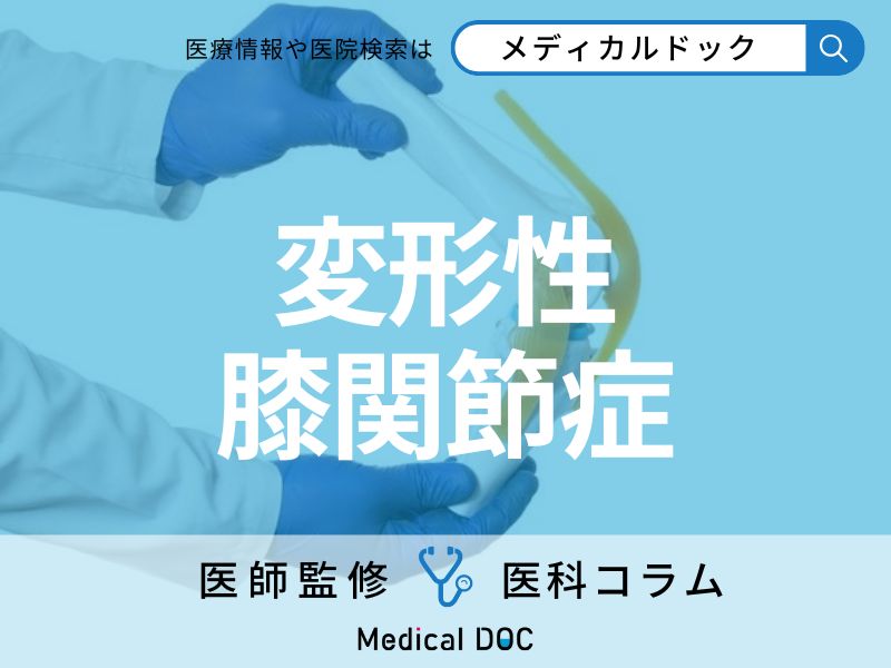 「変形性膝関節症」になりやすい人の特徴はご存じですか? 再生医療･手術による治療法も医師が解説!