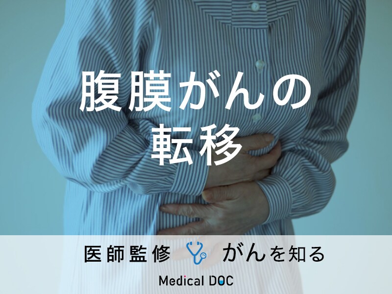 「腹膜がんが転移」するとどうなる？症状や治療法も解説！【医師監修】