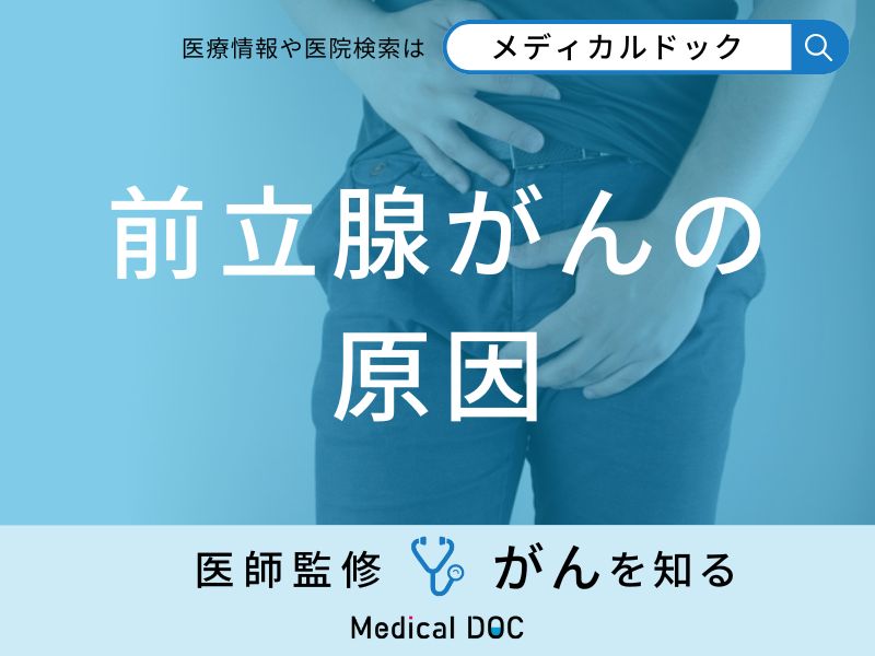 「前立腺がんの主な5つの原因」はご存知ですか？医師が徹底解説！