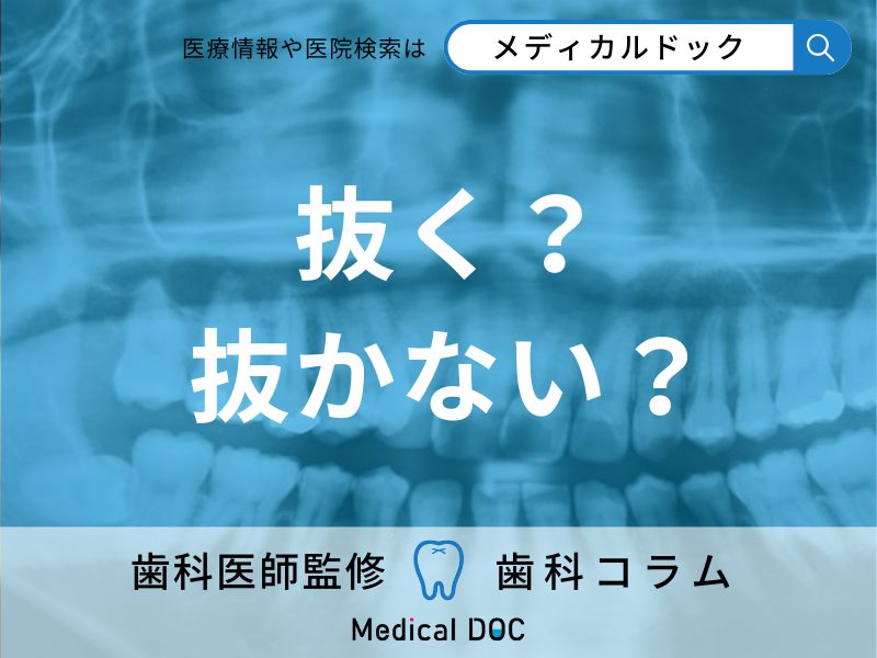 歯科医が教える「親知らず」を抜くかどうかの判断基準 横や斜めに生えていると抜歯しなきゃダメ?