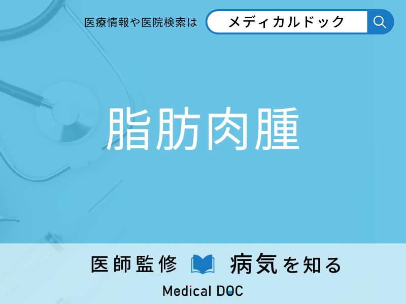 「脂肪肉腫」がよくできる場所はご存知ですか？ 早期発見のポイントを併せて医師が解説