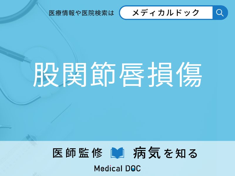 「股関節唇損傷」になりやすい人の特徴はご存知ですか？ 原因・症状を併せて医師が解説