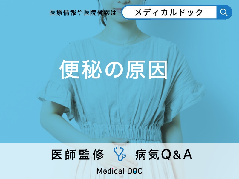 「便秘の原因」はご存知ですか？なりやすい人の特徴や解消法も解説！【医師監修】