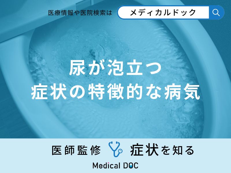 「尿が泡立つ」症状はどんな病気が考えられる？医師が徹底解説！