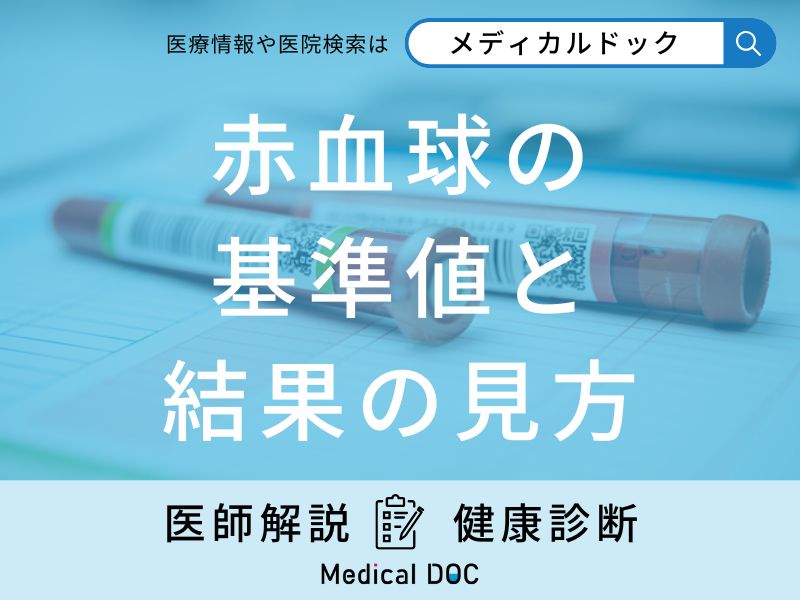 血液検査の「赤血球」の基準値と結果の見方はご存知ですか？医師が徹底解説！