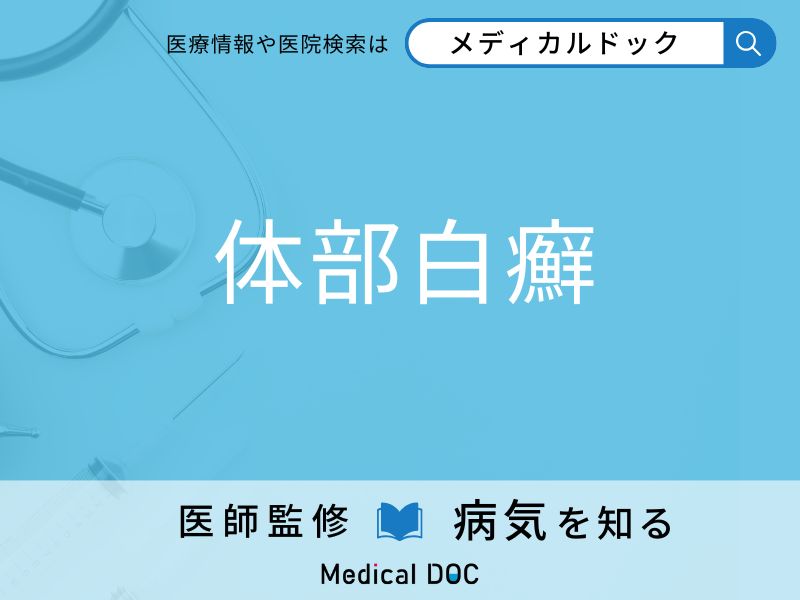 「体部白癬」になりやすい人の特徴はご存知ですか？ 原因・症状を併せて医師が解説