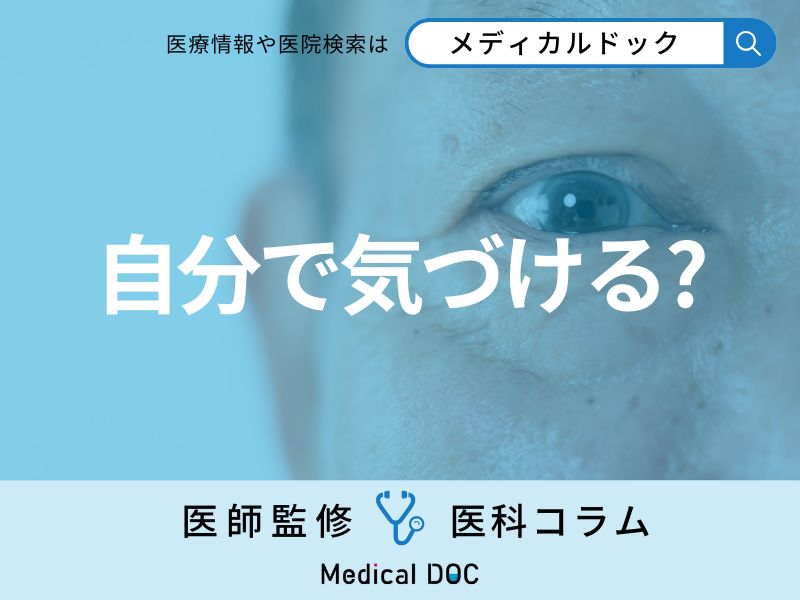 緑内障の初期症状はご存じですか？ 早期発見のポイントとチェック方法も医師が解説