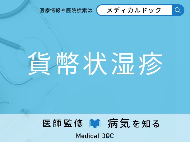 「貨幣状湿疹」の原因・症状を医師が解説 発症しやすい人の特徴とは