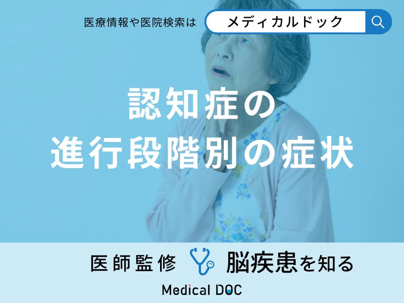 「認知症の進行段階別の症状」はご存知ですか？初期症状も医師が徹底解説！