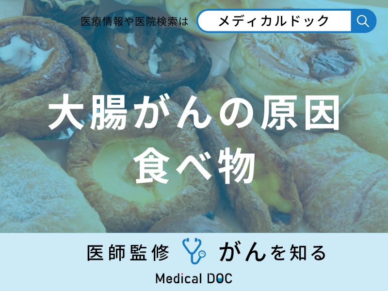 「大腸がんの原因」となる可能性の高い超加工食品はご存知ですか？医師が解説！