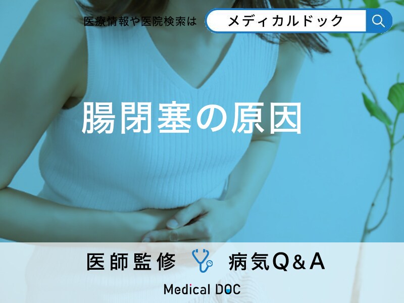 「腸閉塞の原因」はご存知ですか？前兆となる初期症状も解説！【医師監修】