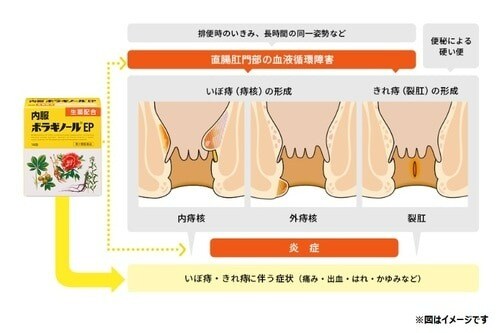 寒さでおしりのトラブル発生!?触るのがイヤなら、のみ薬があるじゃない！の画像25