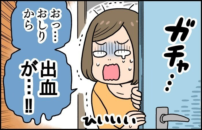 意外と多い！？産後ママのおしりの痛みやトラブルには早めの対処をの画像3