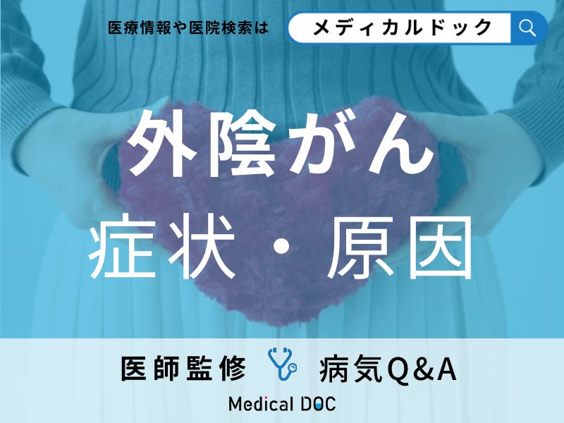 「外陰がん」を発症すると現れる症状とは？原因についても解説！【医師監修】