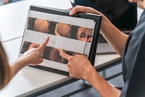 胃カメラで見つかる6つの病と高齢者のデリケートな悩み。介護施設入居中の「通院・付き添い」の注意点