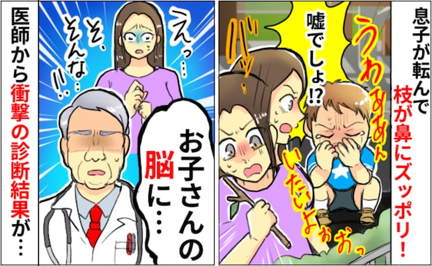 「うそ…」駐車場で息子が転倒、ギャン泣きする息子の鼻の穴に木の枝が！診察の結果、医師の言葉にゾッ