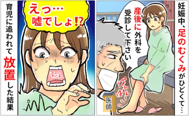 <放置したら激ヤバ展開!>二度の妊娠・出産を経て「足のむくみ」が悪化、思いもよらない結果に!