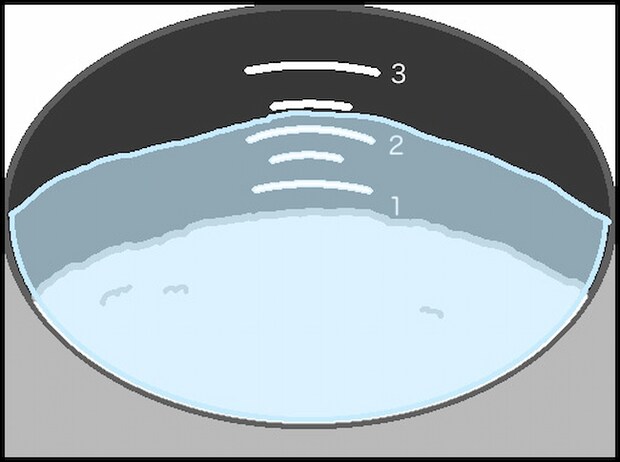 頑張り過ぎない介護／まる子