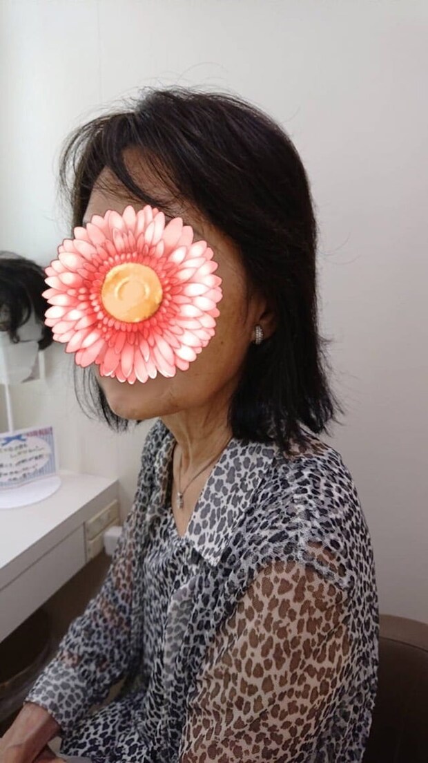 母の認知症介護日記／ワフウフ