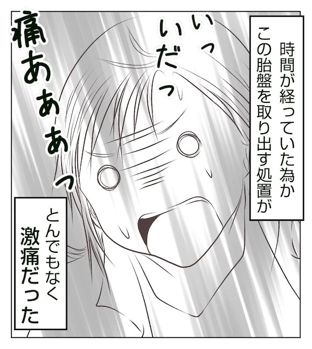 真冬の車内で出産した話 9