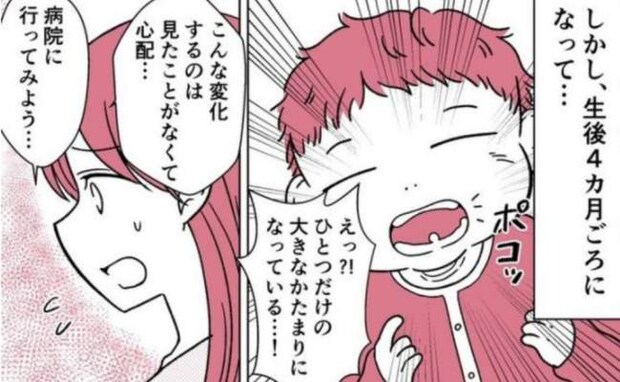 「真珠…？」生後4カ月の娘の口の中に異変！慌てて病院を受診すると、聞いたことのない診断名にあぜん